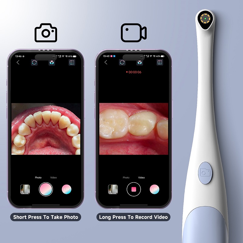 Oral Endoscope Camera 1440P Ph - огляд і ціна Photography Lighting Description